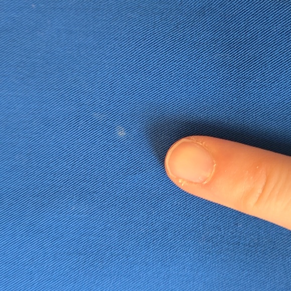 FIGS Blue Short Sleeve Scrub Top, Womens Extra Small, Great Condition - Picture 5 of 11